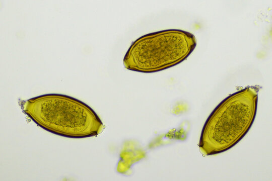 Egg of Trichuris trichiura (whipworm) in human stool, analyze by microscope, original magnification 400x