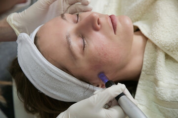 Obraz na płótnie Canvas Mesotherapy. Woman having dermapen facial treatment. Micro needle cosmetic treatment at dermatologist.