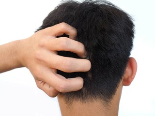 Dandruff or lice in his hair man and scratching her head for healthcare concept. closeup photo.