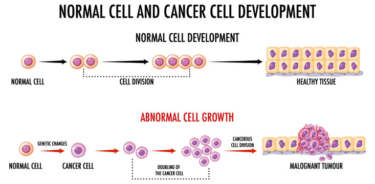 Diagram showing normal and cancer cells