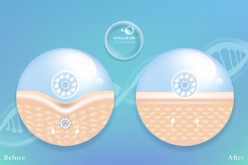 Hyaluronic acid before and after skin solutions ad, blue collagen serum drops with cosmetic advertising background ready to use, illustration vector.