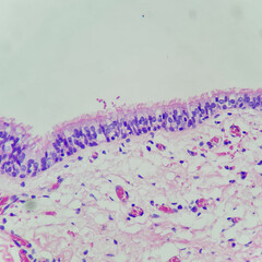 Camera photo of benign respiratory epithelium, showing cilia along luminal surface, magnification 400x, photograph through a microscope - obrazy, fototapety, plakaty
