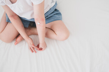 The child scratches atopic skin. The child applies a special cream to atopic skin. Dermatitis, diathesis, allergy on the child's body.