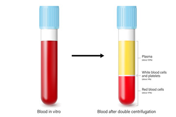 Blood in vitro and blood after double centrifugation. Plasma, red blood cells, white blood cells and platelets. Medical laboratory. - obrazy, fototapety, plakaty