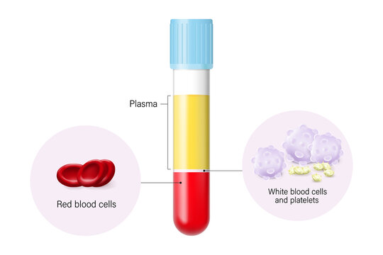 Composition of blood. Plasma, red blood cells, white blood cells and platelets.
