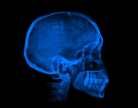Human skull. Blue X-ray image on black background