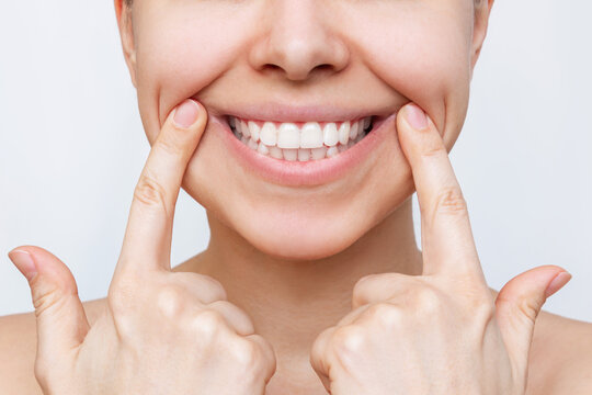 Cropped Shot Of Young Caucasian Woman Demonstrating The Beautiful Smile With Her Hands Isolated On A White Background. Teeth Whitening. Oral Hygiene, Dental Health Care, Perfect Even Teeth. Dentistry