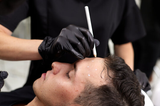 Plastic surgeon preparing for operation on man face