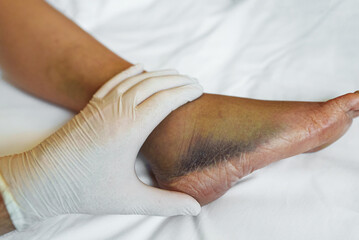 Doctor palpates the injured leg of the patient.