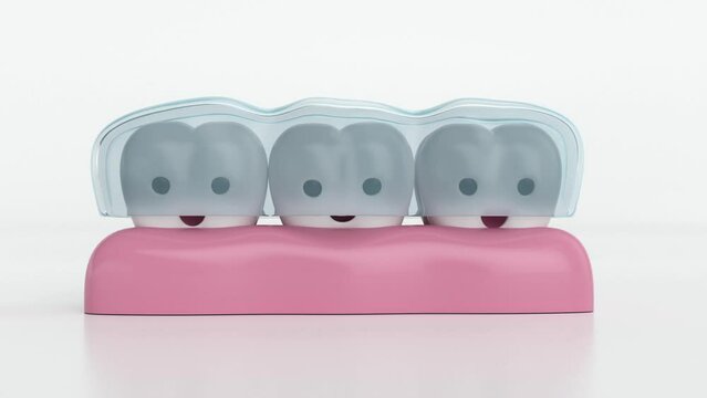 invisible braces, invisalign, happy teeth with invisible braces, 3d animation