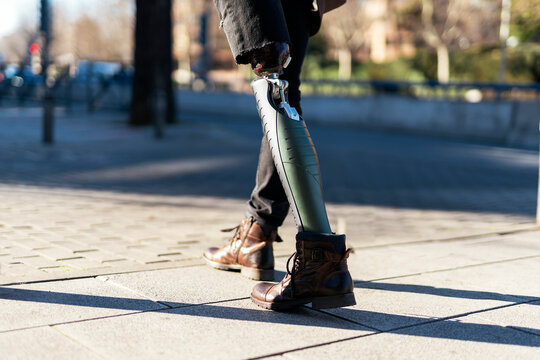 Crop person with artificial limb walking on street