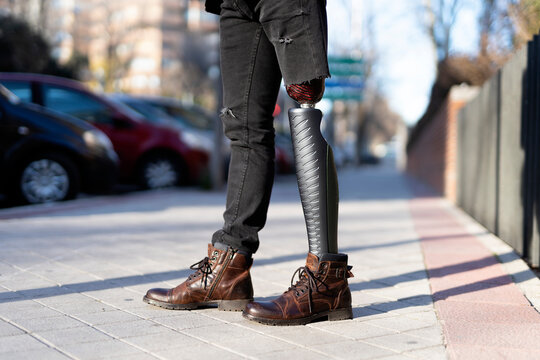 Person with leg prosthesis on sunny street