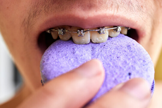 Guy in braces eats a purple cake