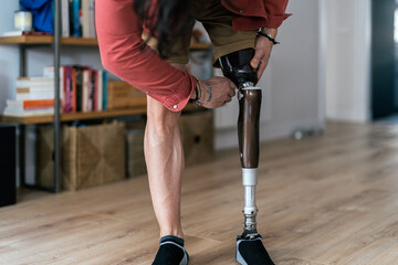 Faceless person fixating prosthetic leg