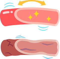 柔らかい血管と硬い血管