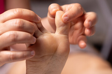 Nurse inspecting the foot of a patient with athlete's foot