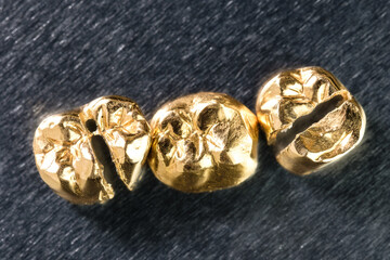 Zahngold / Goldzähne - drei Goldkronen (Altgold, Edelmetall, Recycling) 