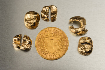Eine schweizer Goldmünze umringt von goldenen Zähnen (Zahngold / Goldkronen) / Vreneli Schweiz 20...