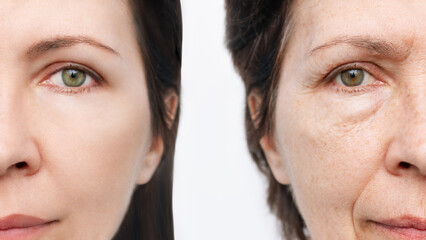 Comparison of the face of young and aged women. Youth, old age. The process of aging and...