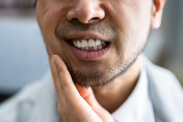 Sore Tooth And Decay. Man Dental Health