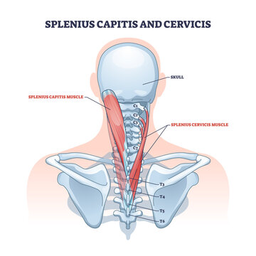Splenius capitis and cervicis muscle location in human neck outline diagram. Labeled educational scheme with spinal vertebrae discs and muscular system vector illustration. Upper body physiology.
