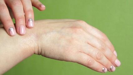 Female hands close-up on a green background. Irritated dry skin with an allergic reaction. A woman...
