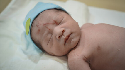 A wound on the newborn's forehead caused by a scalpel in the delivery room. Close up Newborn Baby in the Incubator with Wounds on the Forehead Happened from  the cesarean section.