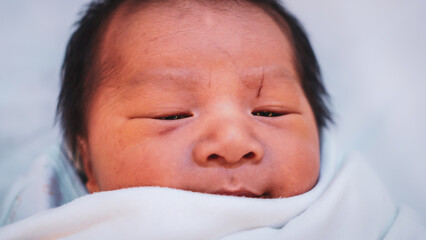 A wound on the newborn's forehead caused by a scalpel in the delivery room. Close up Newborn Baby in the Incubator with Wounds on the Forehead Happened from  the cesarean section.