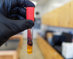 A tube of triple sugar iron agar,  positive for Salmonella.  Color Color change and gas production are visible.