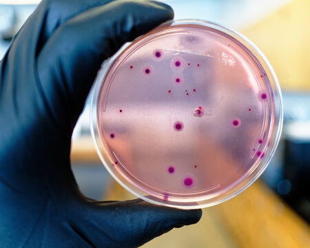 Bacteria growing on VRB agar from a food sample.