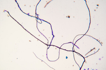 Tissue fibers from the crime scene under a microscope. Physical evidence of the offender's identity...