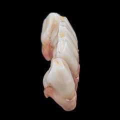 super natural metal ceramic bridge on implants