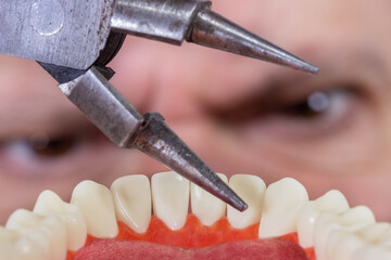 A man wants to rip out a tooth with forceps, view from patient's mouth, close up.