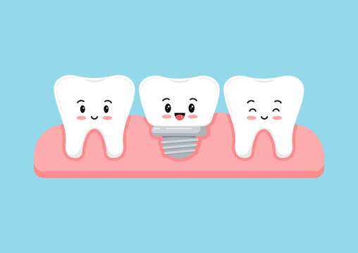 Tooth and dental implant in gum isolated on blue background. Healthy human teeth and implant prosthesis concept. Flat design cartoon style vector orthodontist