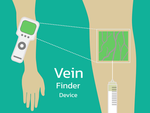 Vein finder is medical device to help find vein so easy