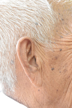 ear of an old man surrounded by white hair.