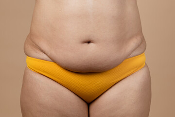 Cropped image of overweight fat pregnant woman sag stomach with obesity, excess fat in yellow...