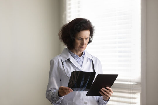 Focused serious senior doctor woman examining xray radiography images, diagnosing bones, joints disease. General practitioner, surgeon concerned about bad screening test result, reviewing scans