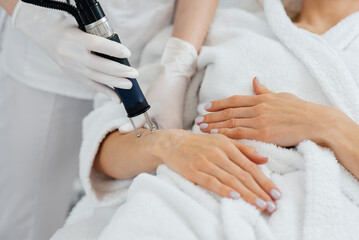 A young girl gets carbon peeling for the skin of her hands in a beauty salon. Laser pulses cleanse the skin. Hardware cosmetology. The process of photothermolysis, warming the skin.