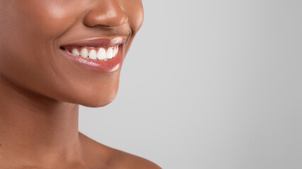 Dental Advertisement. Closeup Shot Of Beautiful Smile Of Young Black Woman