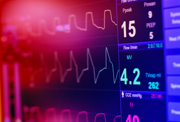 Examine the EKG in an intravenous balloon pump in the ICU on a blurred background. brain waves in...