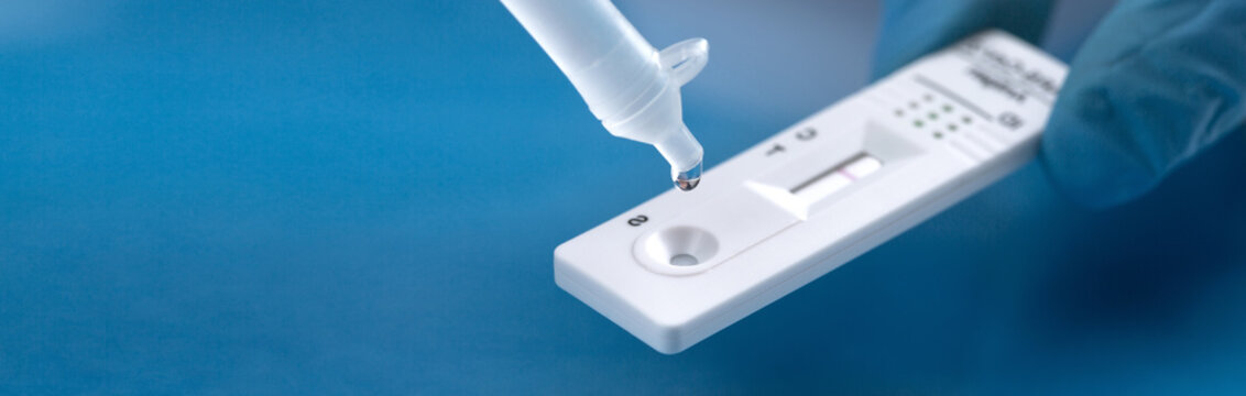 Negative test result by using rapid test device for COVID-19.