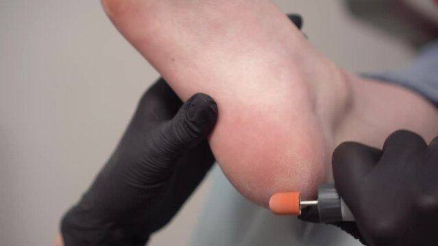 Pedicure master cleans the heel of the patients