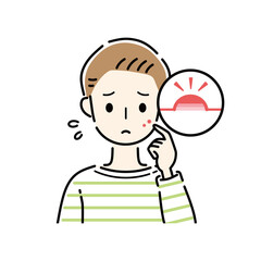 男性　ニキビ　吹き出物