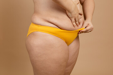 Cropped image of overweight fat woman stomach with obesity, excess fat in yellow swimsuit. Fast...