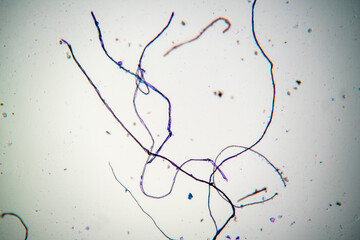 Tissue fibers from the crime scene under a microscope. Physical evidence of the offender's identity...