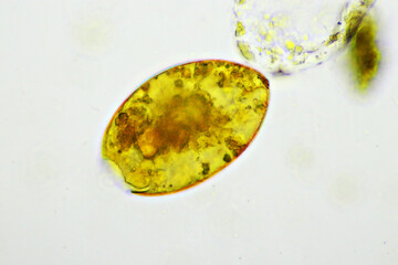 Egg of intestinal fluke in human stool, analyze by microscope, original magnification 400x