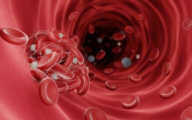 Blood clots (fibrin clots) are usually formed to stop the bleeding during injury, Blood clots can be dangerouse when they obstruct blood flow and cause thrombosis