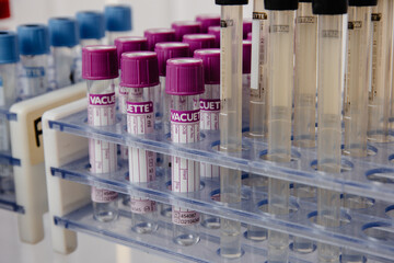 test tubes in laboratory, covid test tubes. 