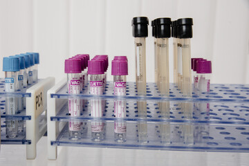 test tubes in laboratory, covid test tubes. 